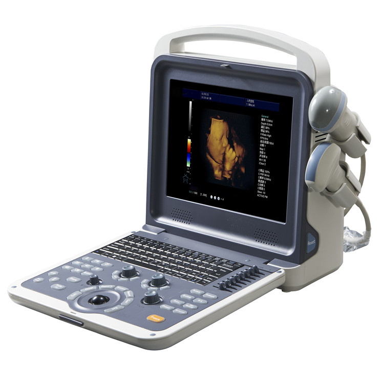 4D Colour Doppler Ultrasound 