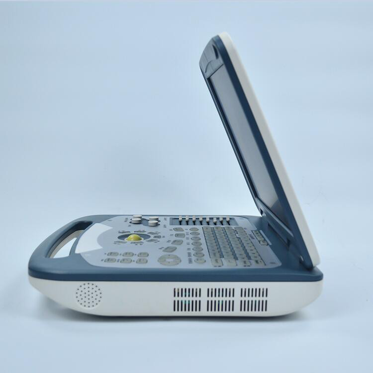 Ultrasound Ultrasound