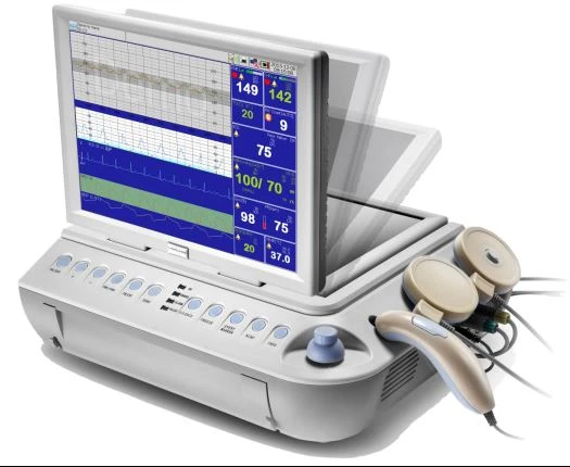 FETAL MONITOR FETAL MONITOR