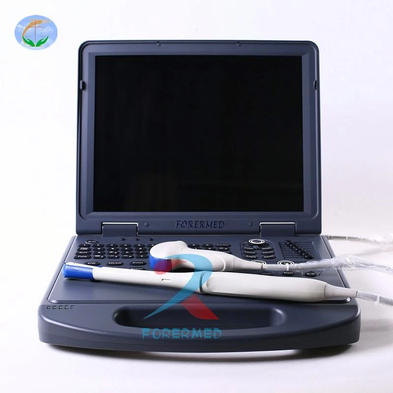 Henan Portable Color Doppler Ultrasound Scanner YJ-C60 -20_ Henan Portable Color Doppler Ultrasound Scanner YJ-C60 -20_
