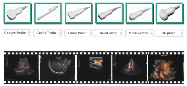 Multipurpose Color Doppler Diagnostic System