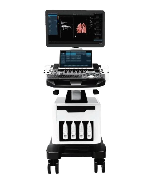 ultrasound ultrasound