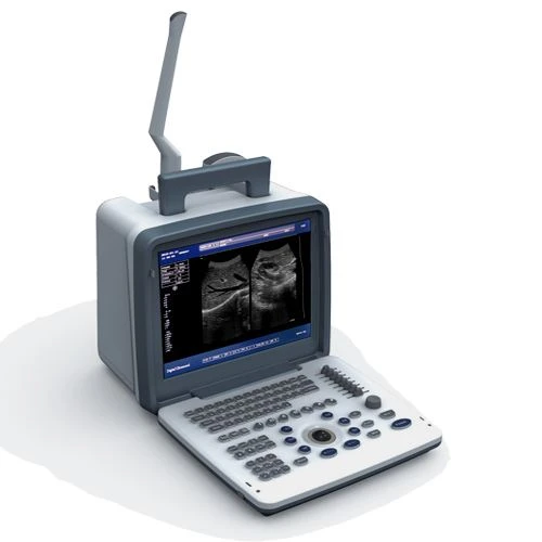 B/W Ultrasound Machine B/W Ultrasound Machine