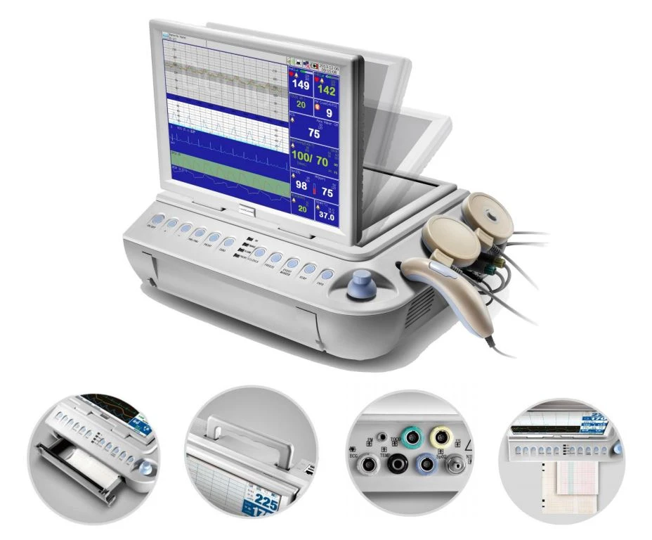 FETAL MONITOR2 FETAL MONITOR2