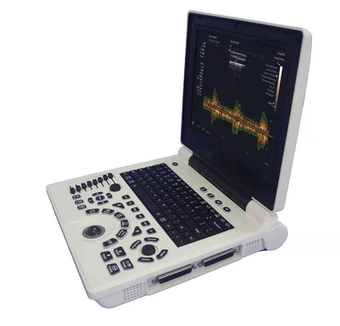 color doppler ultrasound scanner color doppler ultrasound scanner