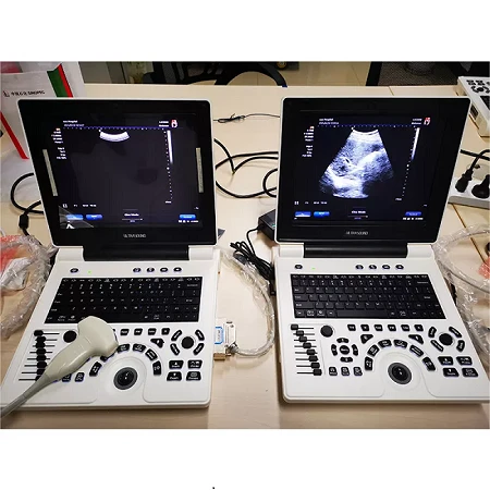 ultrasound color