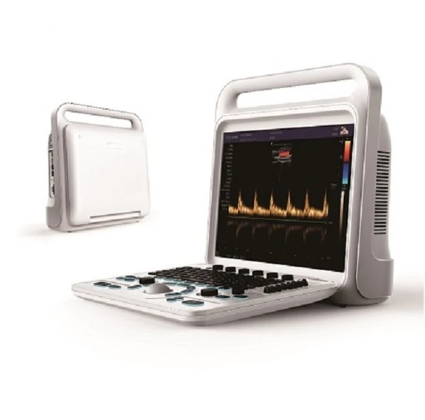 doppler ultrasound