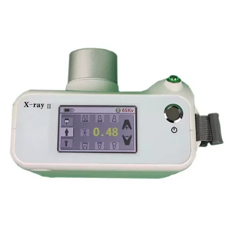 YJ-DXP02 Portable x-ray dental rvg YJ-DXP02 Portable x-ray dental rvg