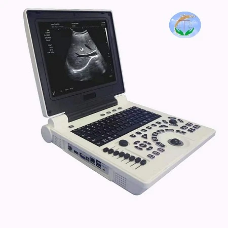 3D color doppler ultrasound scanner 3D color doppler ultrasound scanner