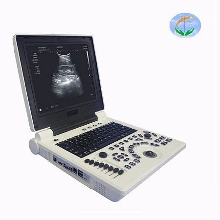 p20 ultrasound scanner