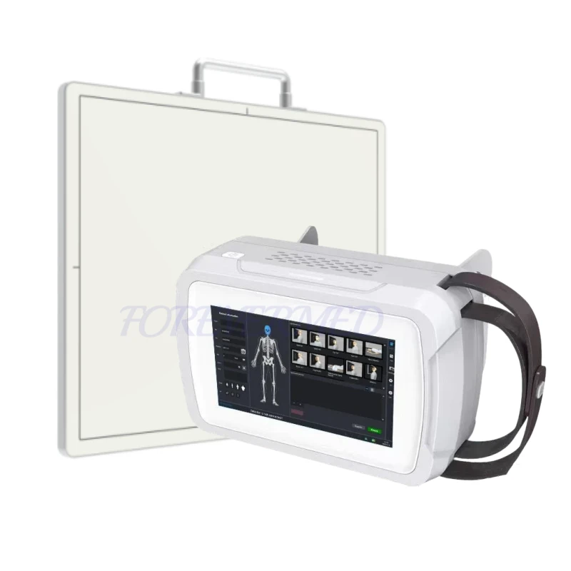 Portable Medical X Ray Machine best Portable Medical X Ray Machine best