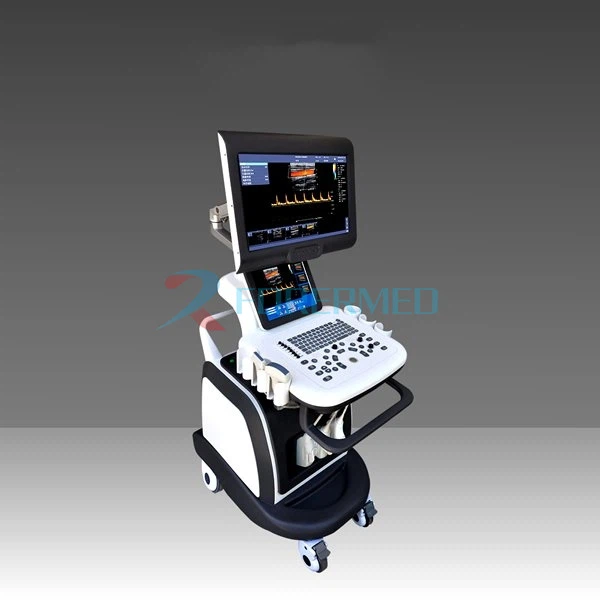 4D COLOR doppler ultasound 4D COLOR doppler ultasound