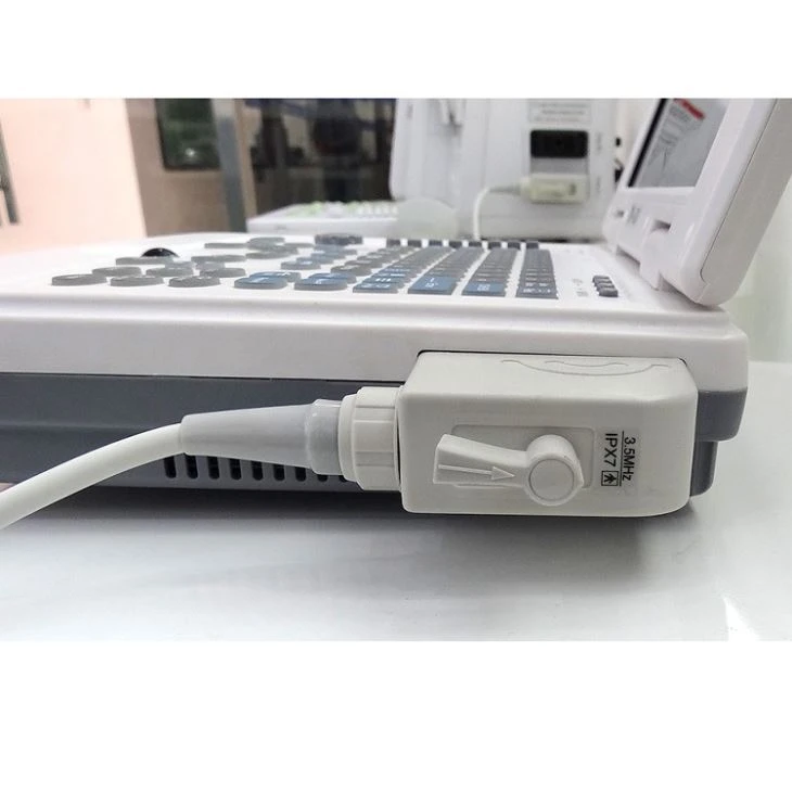 SGS Notebook Ultrasound Diagnosis System SGS Notebook Ultrasound Diagnosis System