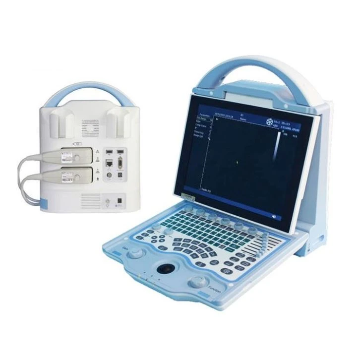 B/W System Digital Portable Ultrasound Scanner B/W System Digital Portable Ultrasound Scanner