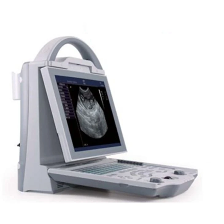 Máy quét siêu âm di động kỹ thuật số hệ thống B / W