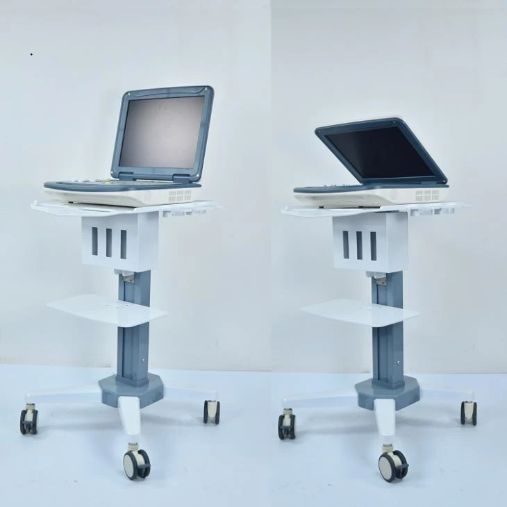 Radiology Ultrasound Diagnosis System Radiology Ultrasound Diagnosis System