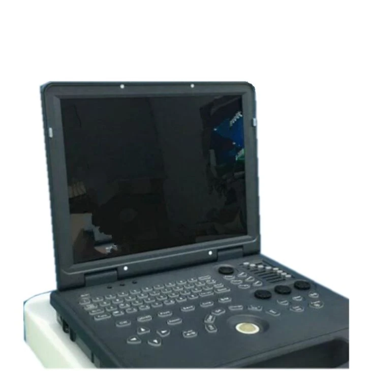 Sonogram Ultrasound‎