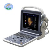 Máy siêu âm Doppler màu y tế cầm tay 4D cho bé