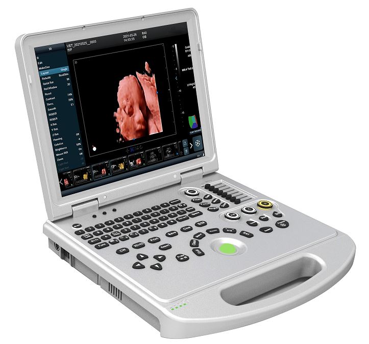 Máy quét siêu âm Doppler màu 5D