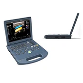 Máy siêu âm Doppler màu laptop