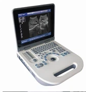 Siêu âm máy tính xách tay kỹ thuật số đầy đủ