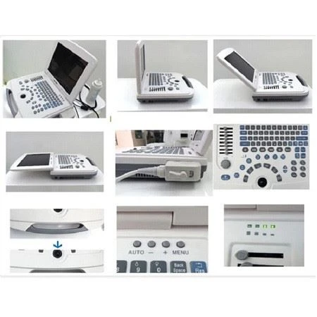 Full-Digital Laptop Ultrasound Scanner Full-Digital Laptop Ultrasound Scanner