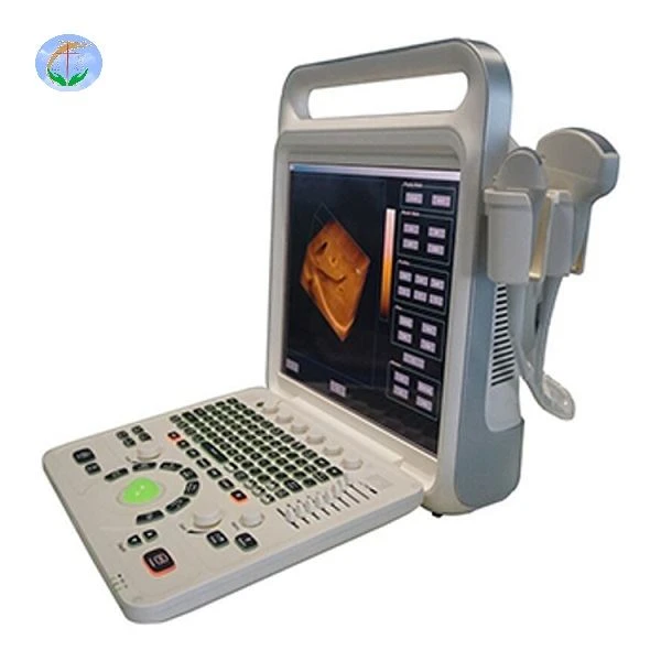 Dụng cụ siêu âm y tế 4d Máy tính xách tay