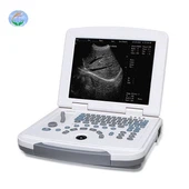 Máy quét siêu âm máy tính xách tay kỹ thuật số đầy đủ YJ-U500