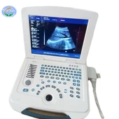 Máy quét siêu âm máy tính xách tay kỹ thuật số đầy đủ