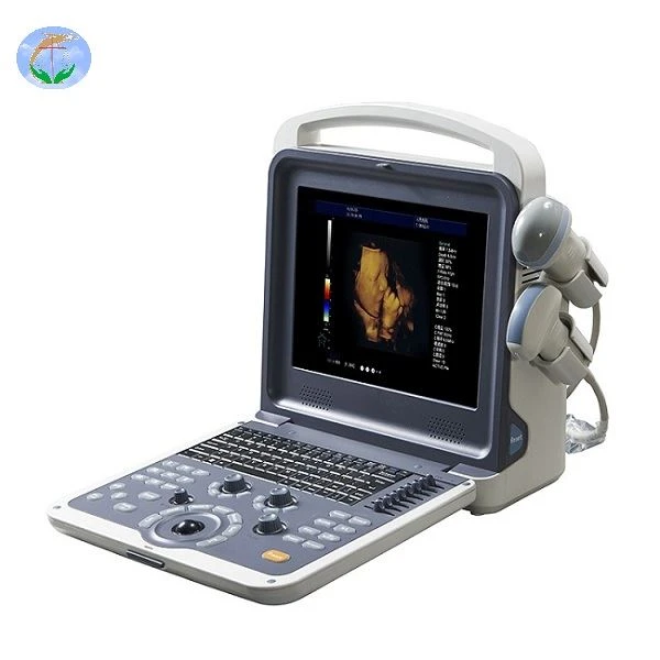 YJ-U60PLUS Color Doppler USG ——Hệ thống chẩn đoán siêu âm Doppler màu kỹ thuật số đầy đủ