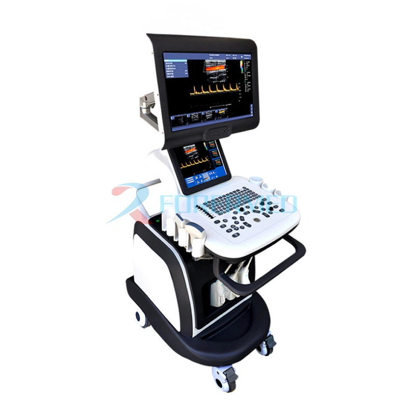 Siêu âm Doppler màu 4D