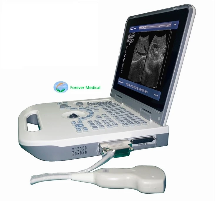 Full-Digital Black And White Laptop Ultrasound Scanner