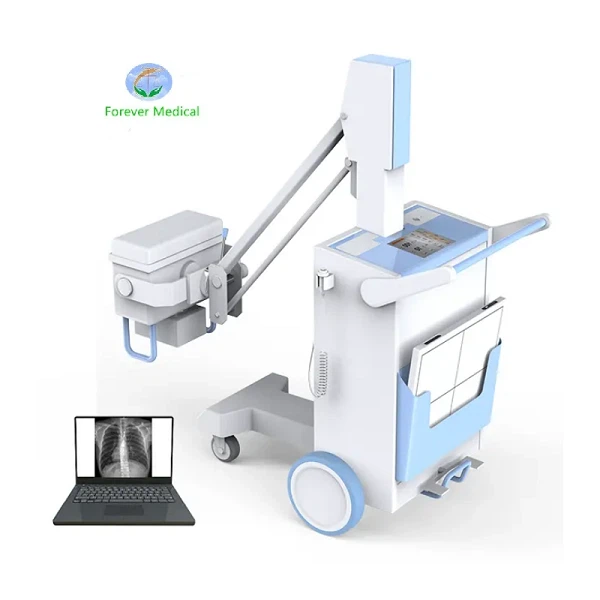High Frequency Mobile Digital X-ray Equipment DR X Ray System